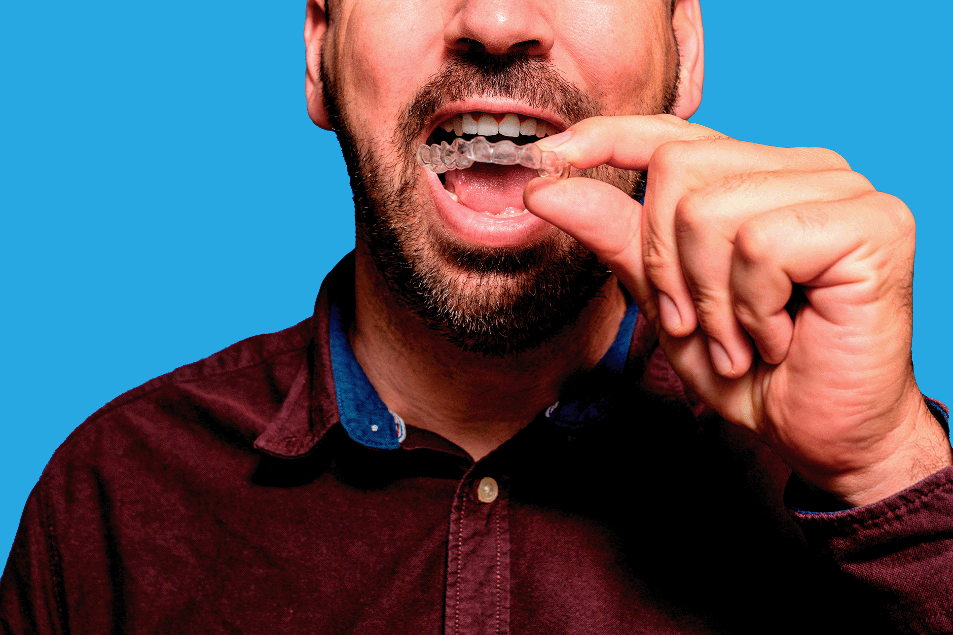 Close up of middle aged man with short beard, inserting his invisalign clear aligner