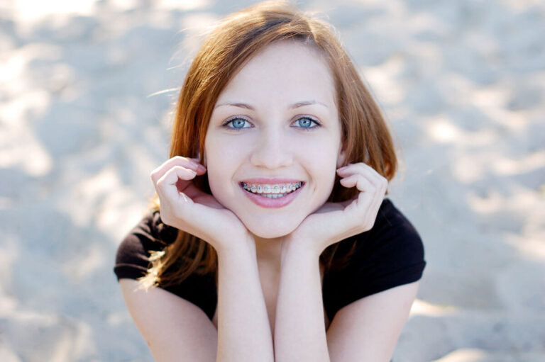 Young woman with braces red hair and striking blue eyes smiling and resting her chin in her hands