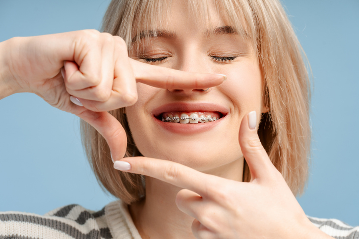 Young woman with braces making a photo frame around her smile with her fingers