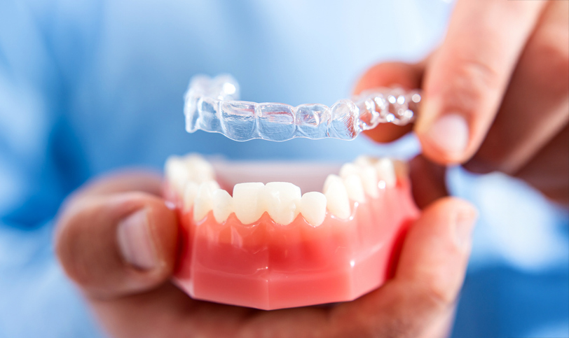 Close up of an orthodontist placing a clear plastic retainer on a hard plastic dental model