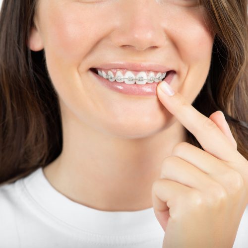 Beautiful young woman with braces