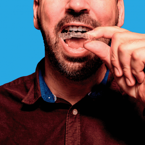 Close up of middle aged man with short beard, inserting his invisalign clear aligner